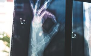 Read more about the article The Best Ways to Improve Your Health After a Heart Attack